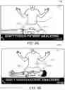 Fig. 13 - Pediatric and adult defibrillator