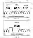 Fig. 17 - Pediatric and adult defibrillator