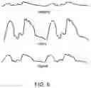 Fig. 07 - Stem cell rich plasma compositions and uses thereof for treating aging subjects