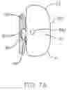 Fig. 08 - Method and apparatus for tooth-movement regulation
