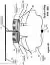 Fig. 49 - Aerosol protection helmet