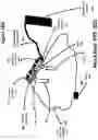 Fig. 50 - Aerosol protection helmet