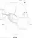 Fig. 03 - ADJUSTABLE FACEMASK