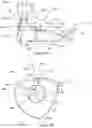 Fig. 18 - Golf club head