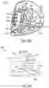 Fig. 45 - GOLF CLUB HEAD