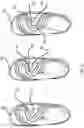 Fig. 03 - Children's shoe with motorized accessory system