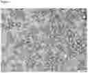 Fig. 02 - Process for the preparation of microcapsules