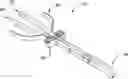 Fig. 01 - Retrofittable auxiliary pliers handle assembly