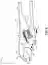 Fig. 03 - Locking pliers with one-hand adjustment