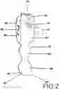 Fig. 03 - Surface wedge tool