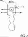 Fig. 04 - Surface wedge tool