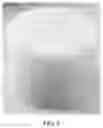 Fig. 05 - Self-rotation cleaning device and device for cleaning photo-cured tissue engineering scaffold