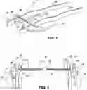 Fig. 02 - Vehicle overload suspension system