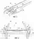 Fig. 03 - Vehicle overload suspension system