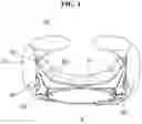 Fig. 02 - Side airbag for vehicles