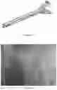 Fig. 28 - Supporting rod of vehicle component, system of integrating support and vibrational damping and process for manufacturing of a supporting rod of vehicle component