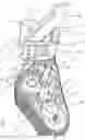 Fig. 07 - Assembly for Converting a Wheel Drive Harvester to Track Drive