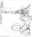 Fig. 16 - Hybrid pump-action vehicle and therapy device