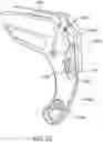 Fig. 25 - Rotationally-engaging two-piece upper chain guide
