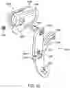 Fig. 27 - Rotationally-engaging two-piece upper chain guide