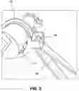 Fig. 04 - SUNSHADE SYSTEM USING LINEAR ACTUATORS AND FREE-FLOATING CANOPY