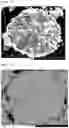Fig. 03 - Positive Electrode Active Material for Lithium Secondary Battery and Method for Preparing Said Positive Electrode Active Material