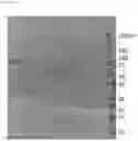 Fig. 09 - HCV protease inhibitors