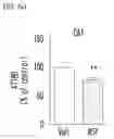 Fig. 18 - PYRROLO-PYRIDINE DERIVATIVE COMPOUND, METHOD FOR PREPARING SAME, AND PHARMACEUTICAL COMPOSITION CONTAINING SAME AS ACTIVE INGREDIENT FOR PREVENTION OR TREATMENT OF PROTEIN KINASE-RELATED DISEASES