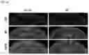 Fig. 25 - PYRROLO-PYRIDINE DERIVATIVE COMPOUND, METHOD FOR PREPARING SAME, AND PHARMACEUTICAL COMPOSITION CONTAINING SAME AS ACTIVE INGREDIENT FOR PREVENTION OR TREATMENT OF PROTEIN KINASE-RELATED DISEASES