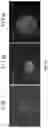 Fig. 12 - HETERODIMER COMPOSITIONS AND METHODS FOR THE TREATMENT OF OCULAR DISORDERS