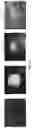 Fig. 15 - HETERODIMER COMPOSITIONS AND METHODS FOR THE TREATMENT OF OCULAR DISORDERS