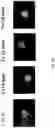 Fig. 21 - HETERODIMER COMPOSITIONS AND METHODS FOR THE TREATMENT OF OCULAR DISORDERS