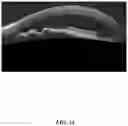 Fig. 32 - HETERODIMER COMPOSITIONS AND METHODS FOR THE TREATMENT OF OCULAR DISORDERS