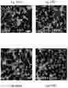 Fig. 05 - Methods of treatment comprising Selenoprotein P fragment-containing compounds