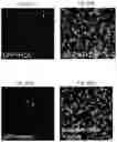 Fig. 06 - Methods of treatment comprising Selenoprotein P fragment-containing compounds