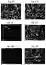 Fig. 08 - Methods of treatment comprising Selenoprotein P fragment-containing compounds