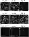 Fig. 14 - Methods of treatment comprising Selenoprotein P fragment-containing compounds
