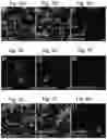 Fig. 15 - Methods of treatment comprising Selenoprotein P fragment-containing compounds