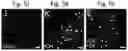 Fig. 27 - Methods of treatment comprising Selenoprotein P fragment-containing compounds