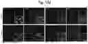 Fig. 28 - Methods of treatment comprising Selenoprotein P fragment-containing compounds
