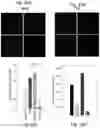 Fig. 45 - Methods of treatment comprising Selenoprotein P fragment-containing compounds