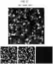 Fig. 46 - Methods of treatment comprising Selenoprotein P fragment-containing compounds
