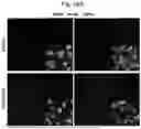 Fig. 47 - Methods of treatment comprising Selenoprotein P fragment-containing compounds