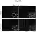 Fig. 49 - Methods of treatment comprising Selenoprotein P fragment-containing compounds