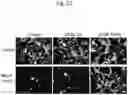 Fig. 55 - Methods of treatment comprising Selenoprotein P fragment-containing compounds