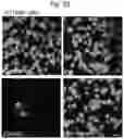 Fig. 83 - Methods of treatment comprising Selenoprotein P fragment-containing compounds