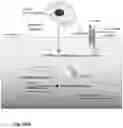 Fig. 99 - Methods of treatment comprising Selenoprotein P fragment-containing compounds