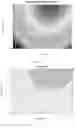 Fig. 03 - MODIFIED RECOMBINANT HUMAN NERVE GROWTH FACTOR AND METHOD FOR PREPARING THE SAME
