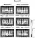 Fig. 37 - MULTIMERIZATION OF IL-15/IL-15R-ALPHA-FC COMPLEXES TO ENHANCE IMMUNOTHERAPY