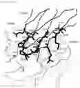 Fig. 45 - Anti-CD147 antibody